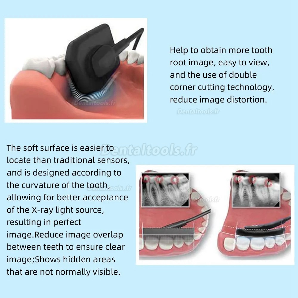 Capteur Radio Dentaire RVG Capteur Intraoral Radiologique Dentaire Numérique